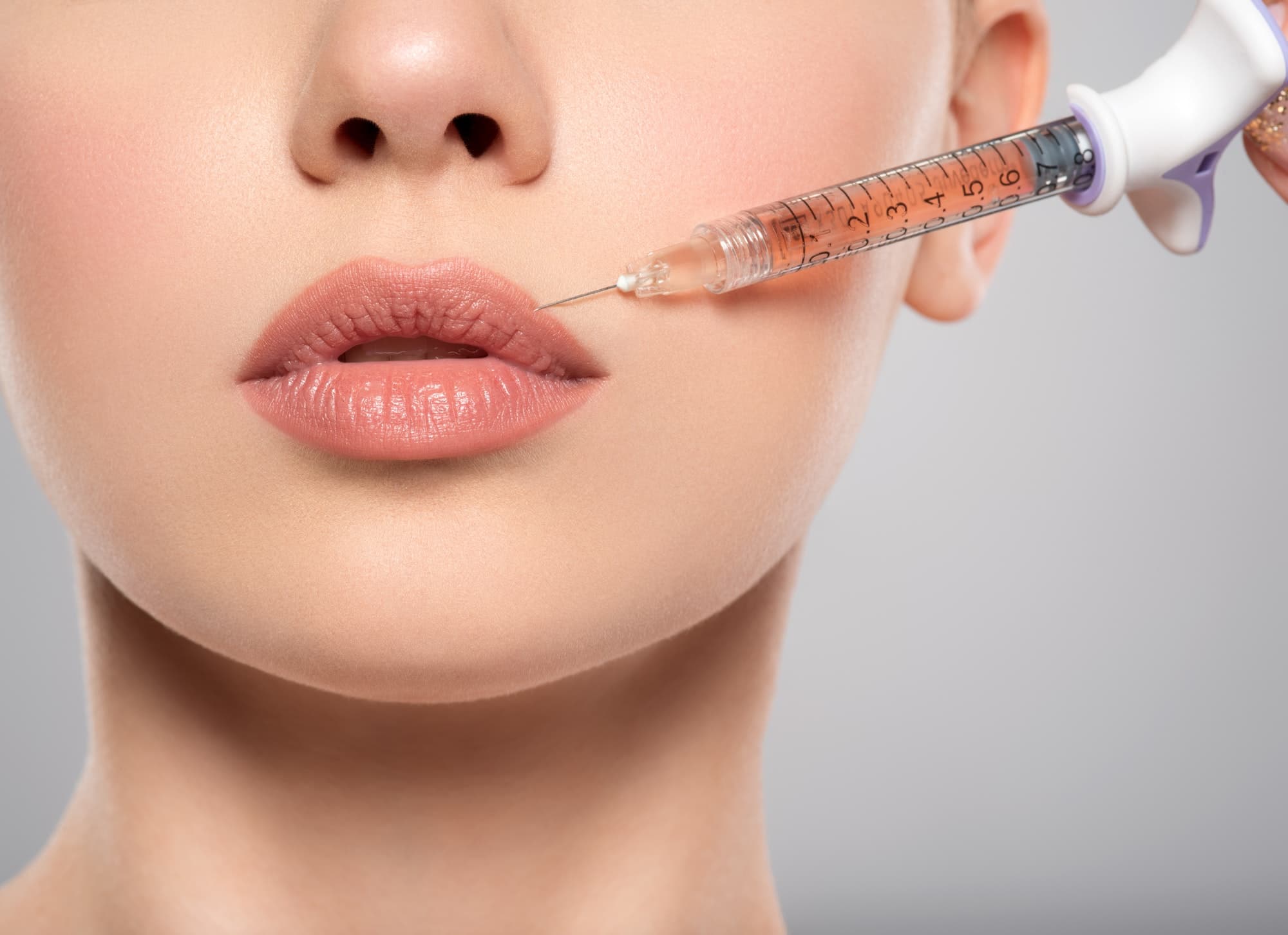 Preenchimento Labial